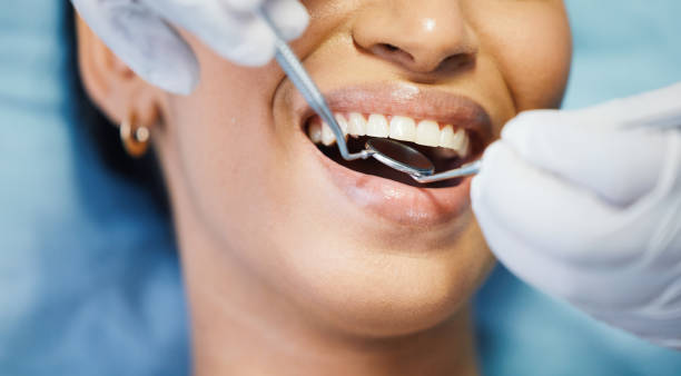 Best Emergency Dental Services for Seniors in Dillonvale, OH