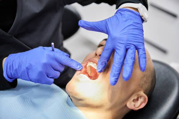 Best Emergency Dentist for Knocked-Out Tooth in Dillonvale, OH